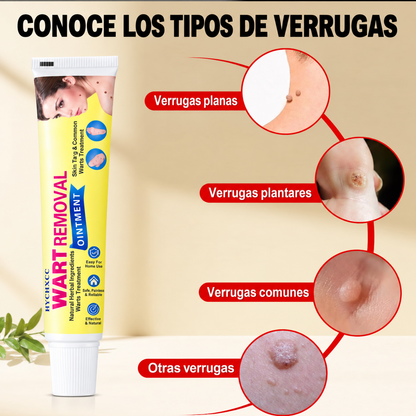 Crema para Remover Verrugas