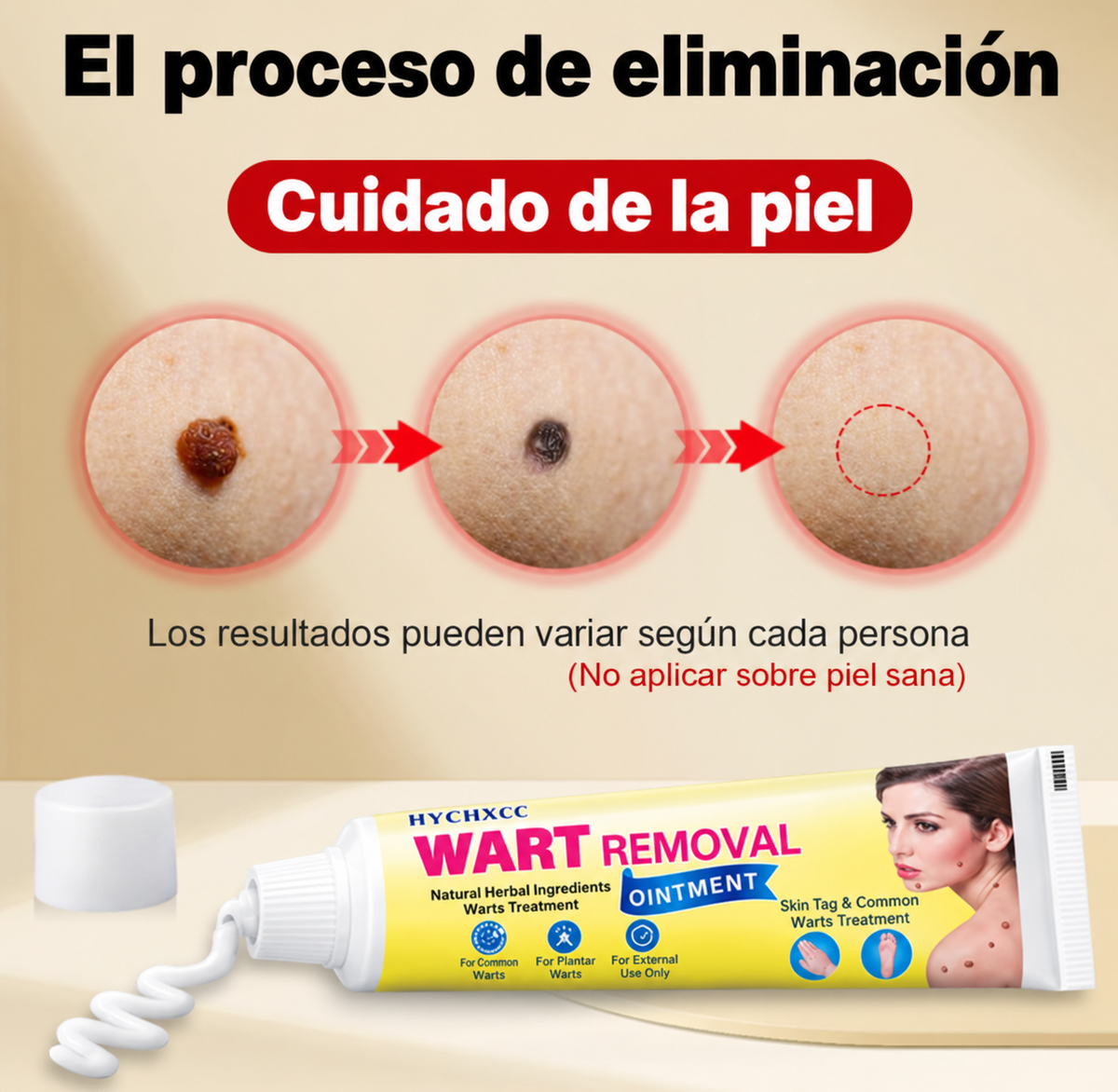 Crema para Remover Verrugas